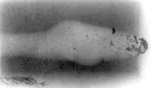 Рис 2. Импульсная рентгенограмма. Взрывоподобная фрагментация 5,56-мм пули патрона М193 в желатиновом блоке (дальность стрельбы -10м, входное отверстие слева).